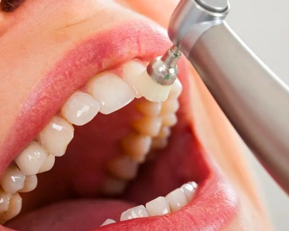 CRYSTALDENT-Periodoncia-02